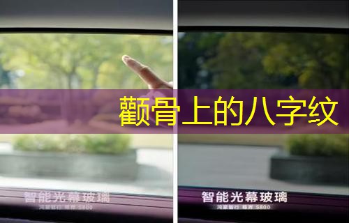  颧骨上的八字纹